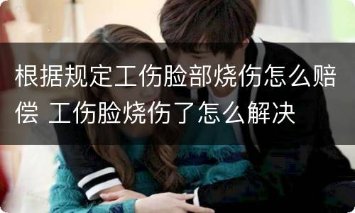 根据规定工伤脸部烧伤怎么赔偿 工伤脸烧伤了怎么解决